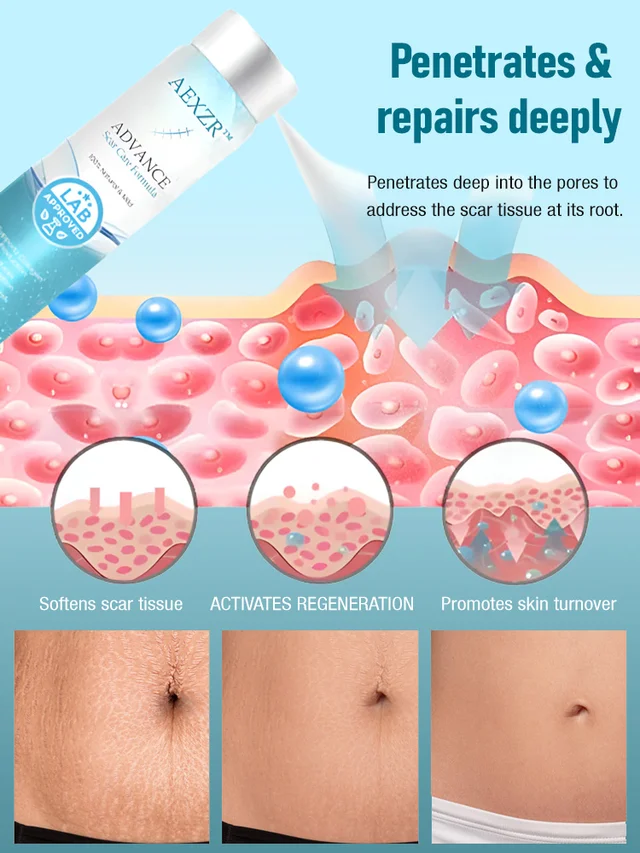 Advanced Scar Removal Spray