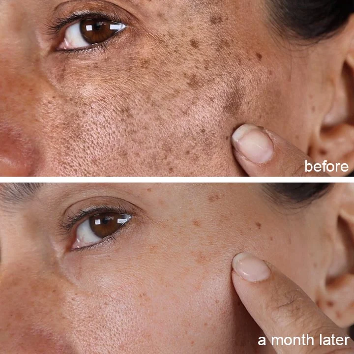 ASMOXA Dark Spot Corrector Cream