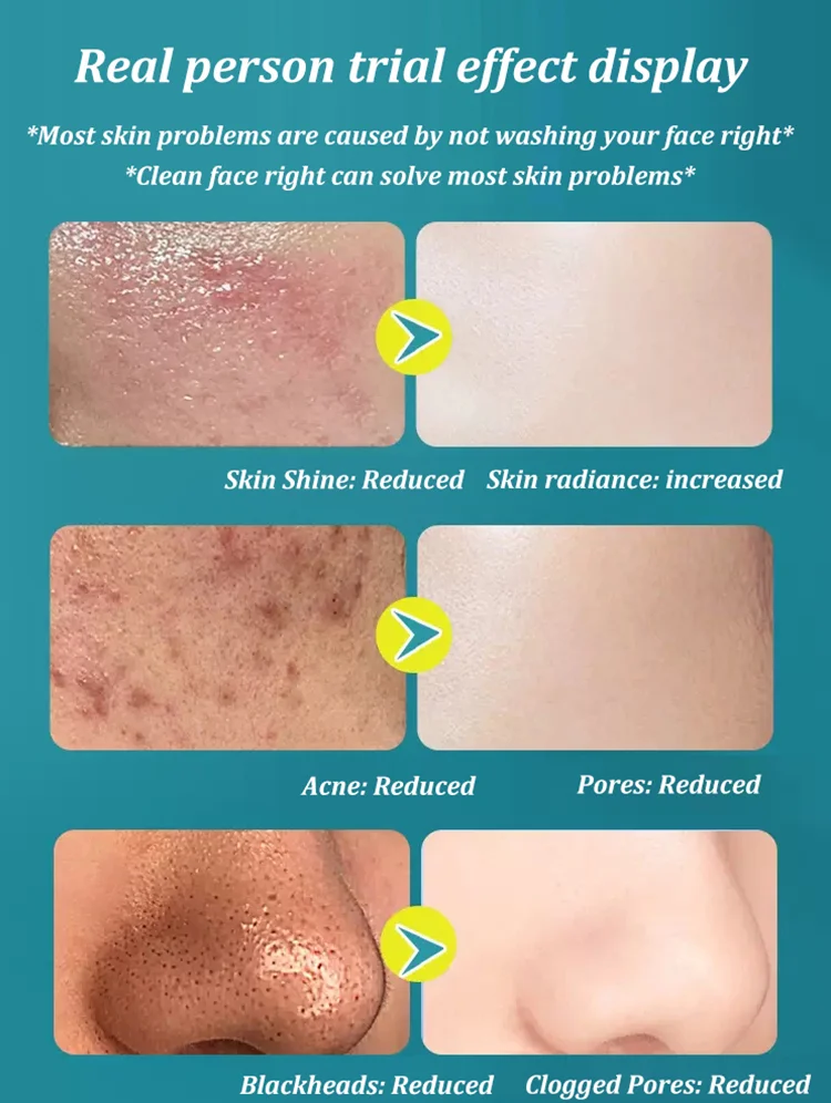 Cuishifan Whitening and Freckle removing Facial Cleanser
