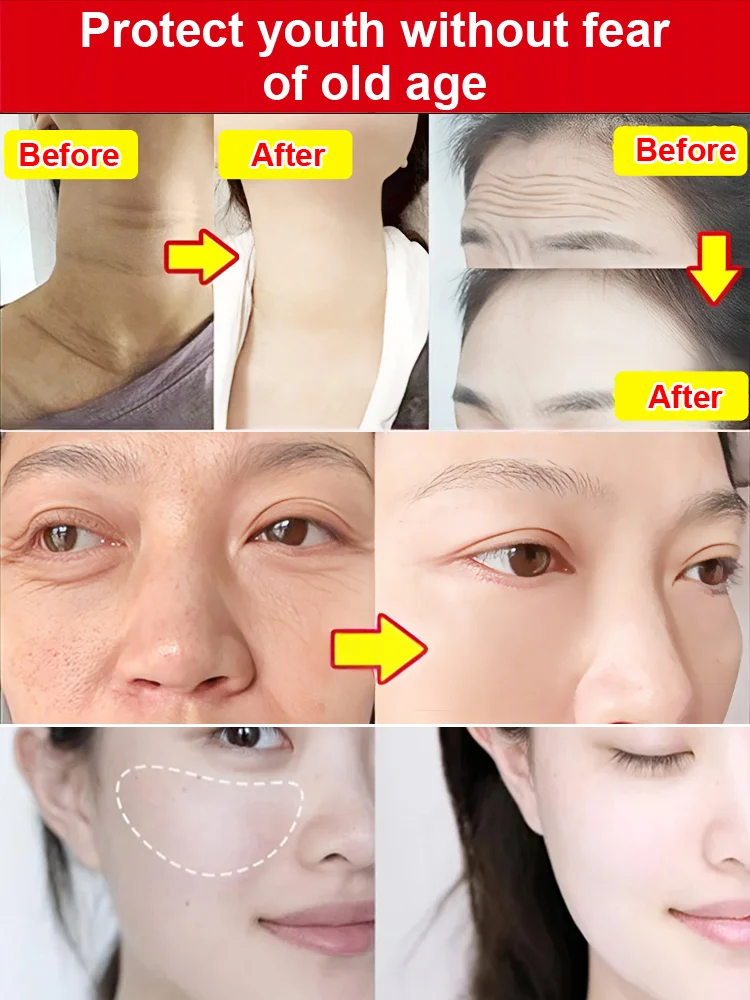 Cordyceps niacinamide anti-wrinkle beauty cream