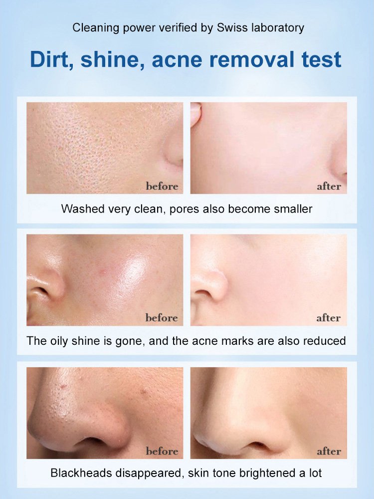 SKIN Whitening Moisturizing Cleanser