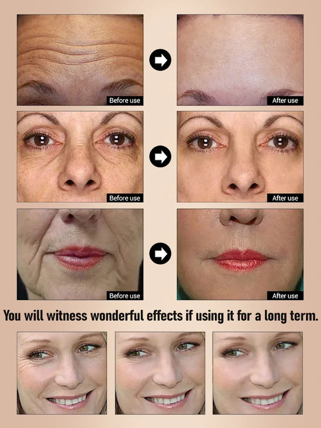 Anti-Aging Wrinkle-Removing Serum