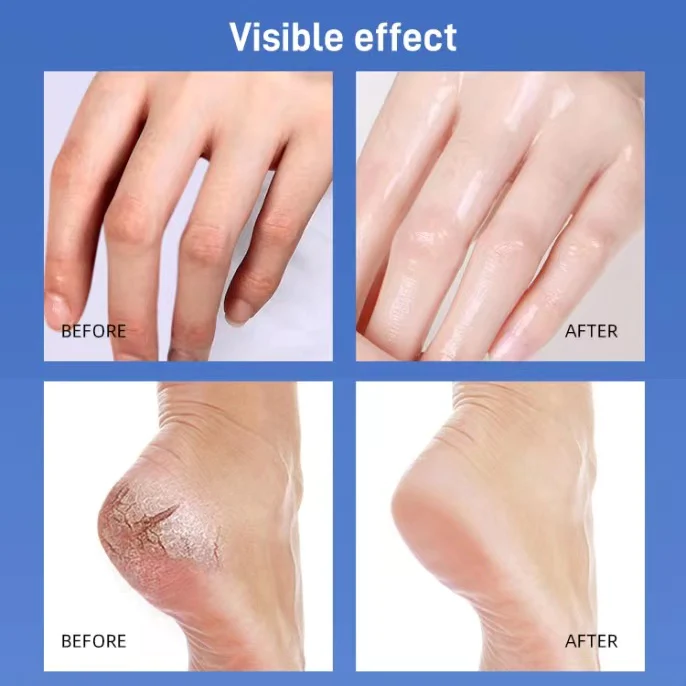 Vaseline Foot Moisturizing Cream Hand Care Cream Anti-Cracking Anti-Drying Softness Skin Care