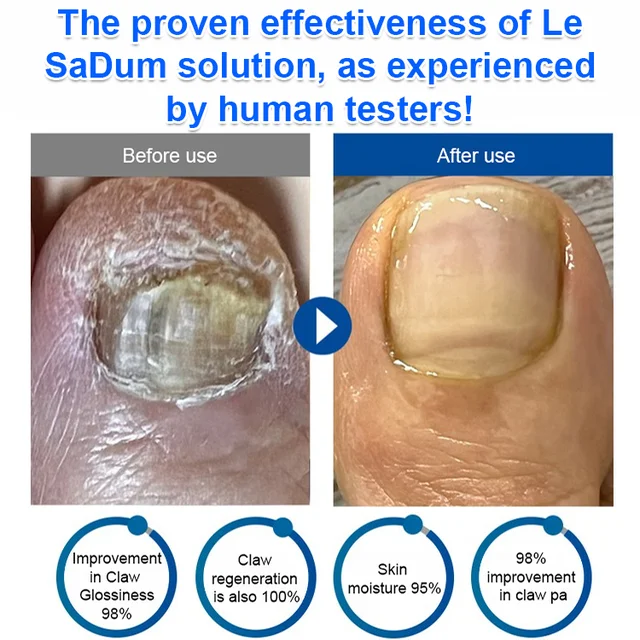 Anti-Foot Odor and Moisturizing Spray