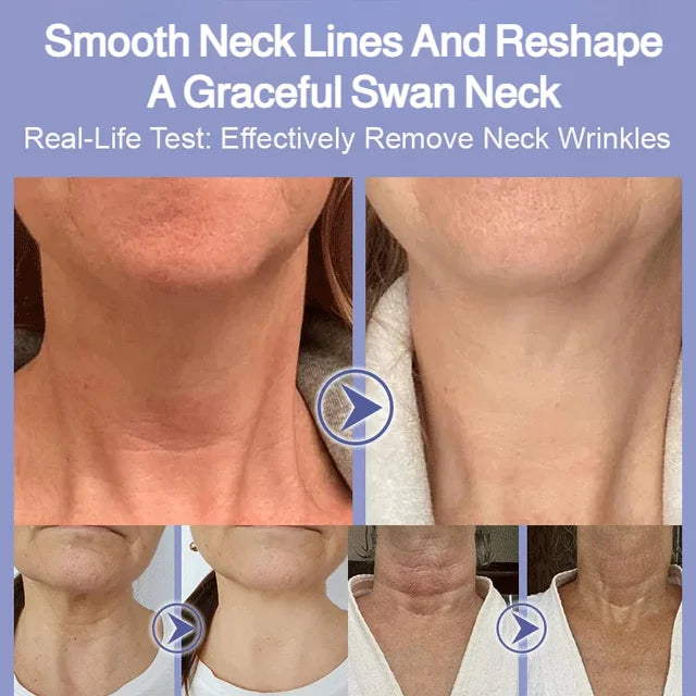 💥BUY 1 GET 1 FREE💥Moisturizing Neck Neck Care Cream
