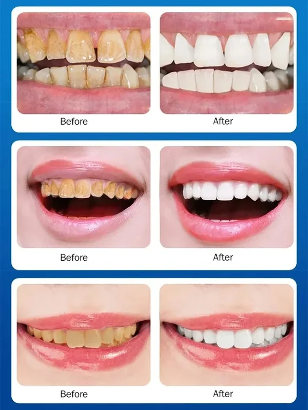 Gold Version Intensive Whitening Toothpaste
