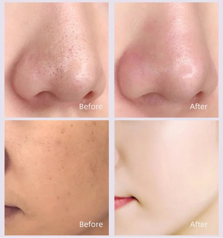 BAMBOO CHARCOAL BLACKHEAD REMOVAL MASK