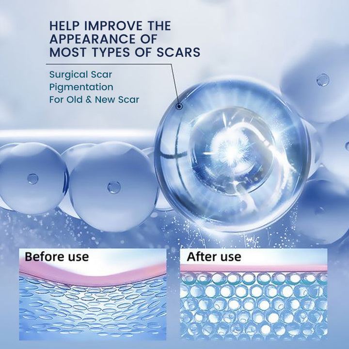 🔥Last Day Discount 🔥Sumifun Texture Repair Gel