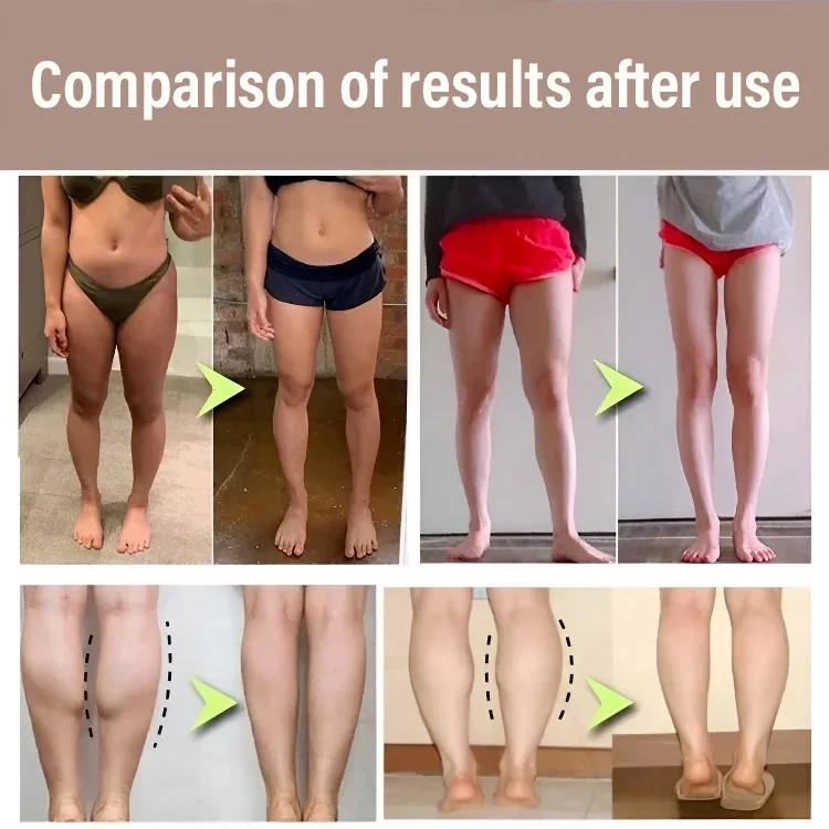 [Three-part compression socks] Wear comic legs