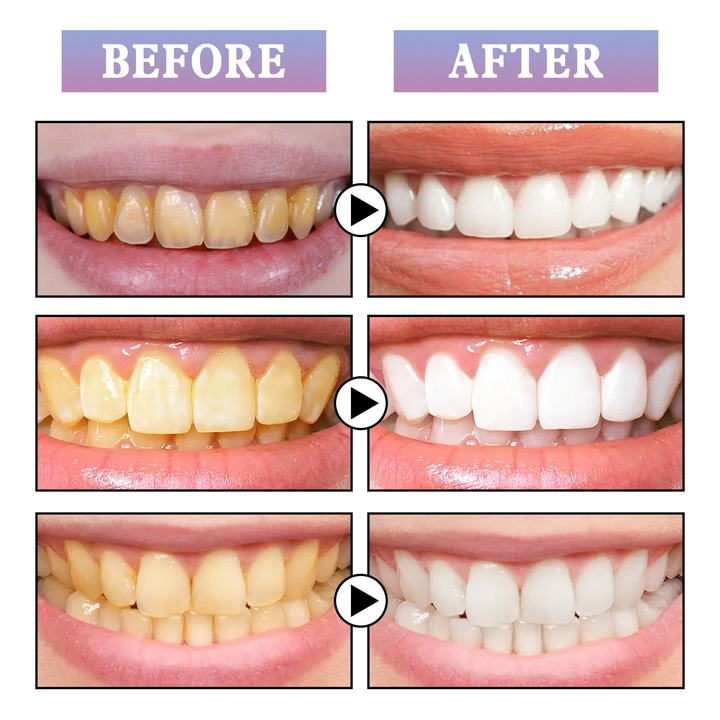 Glostik Tooth Gloss