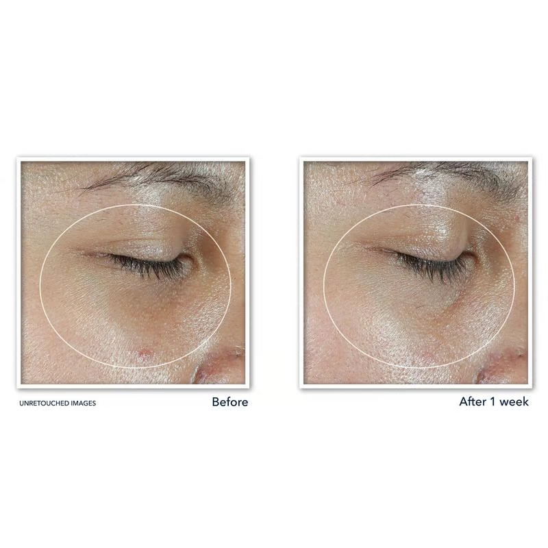 Revive  Glow Eye Balm with Vitamin C brightens and reduces puffiness