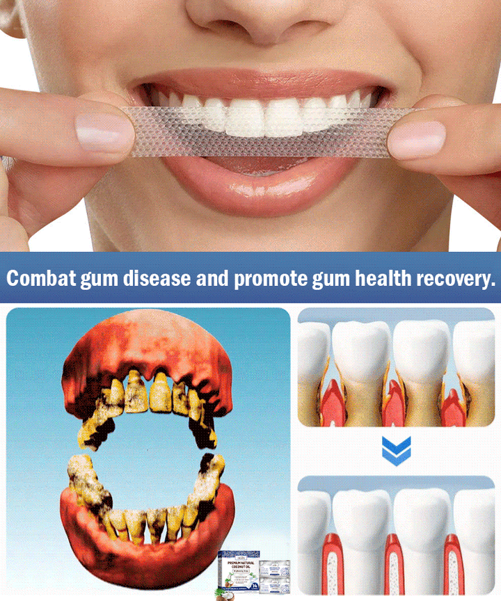 Coconut Mint Whitening Strips
