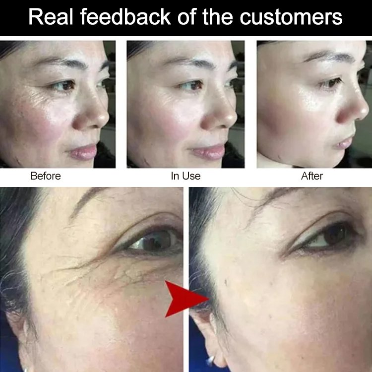 Anti-wrinkle Collagen Protein Cream