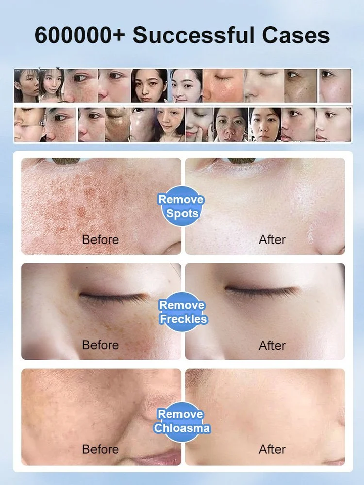 377 Whitening Spots Removal Cream