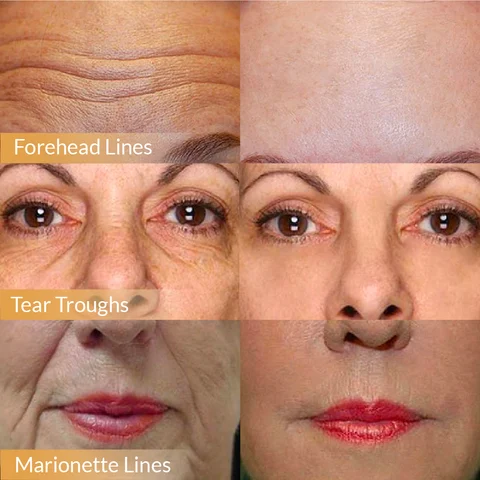 🔥 Buy 1 Get 1 Free🔥2025 Hot Sale Polypeptide Firming Full Face Cream