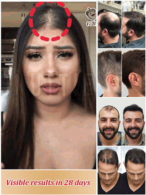 Thickening Anti Fallout Fixing Repairing Shampoo