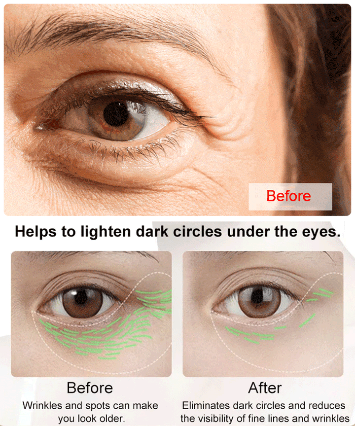 CËLYN FIRM Eye Tightener