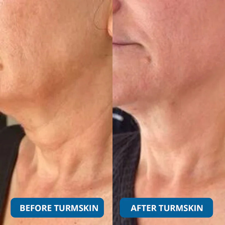 3% Hyaluron Booster for Glass Skin & Anti Aging