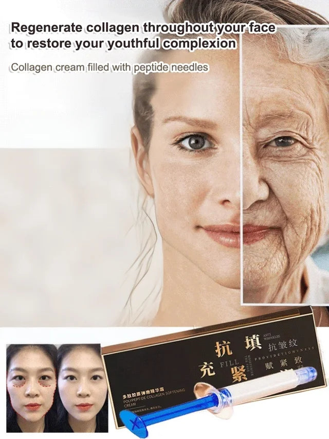 🎁BUY 1 GET 1 FREE🔥Peptide needle-filled collagen cream