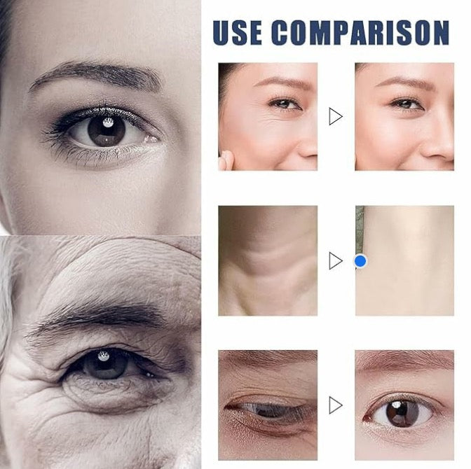 🏆Last day of limited-time discount!⚡Micro-Molecular Collagen Anti-Wrinkle Lotion