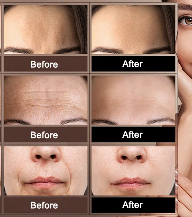 Firming Anti-Wrinkle and Anti-Aging Serum