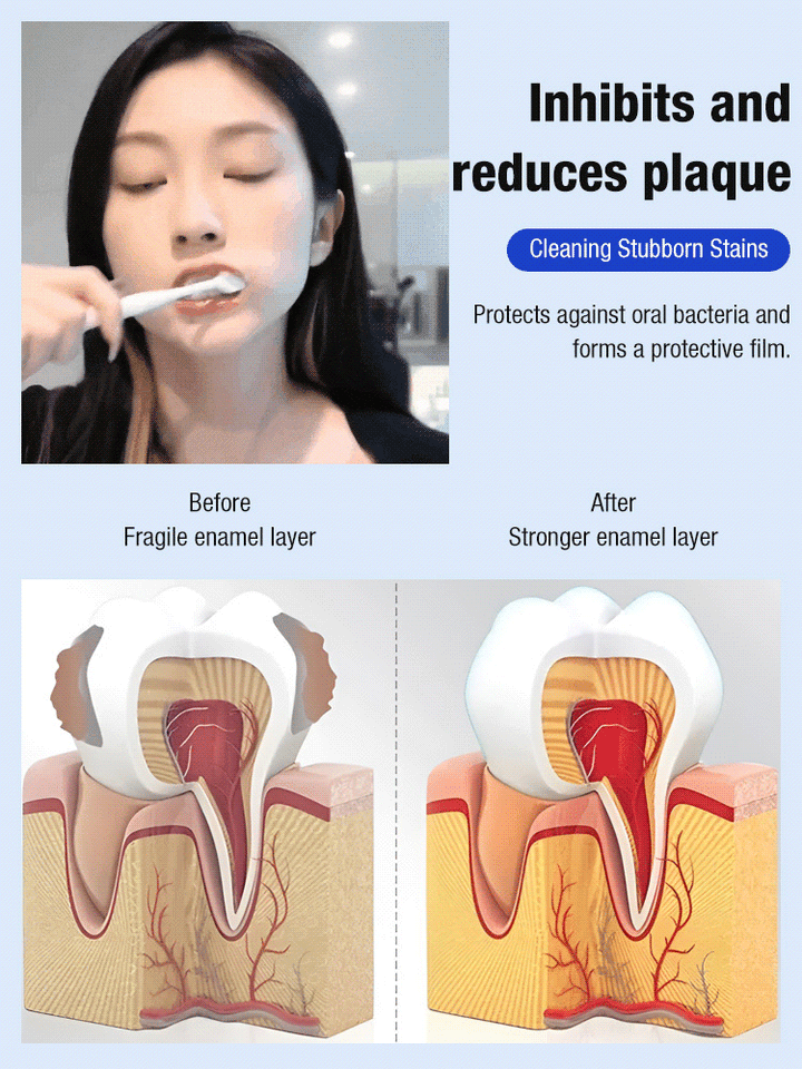 Dental separators