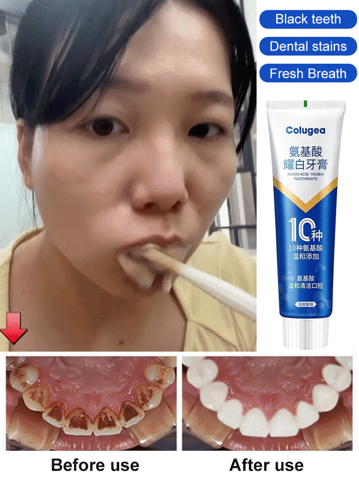 Amino Acid White Toothpaste