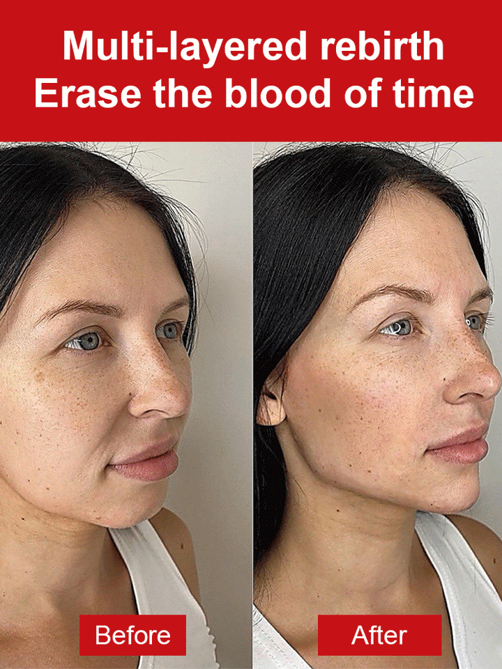 Anti-wrinkle Essence Cream