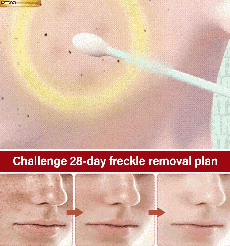 BRIGHTENING FRECKLE CREAM