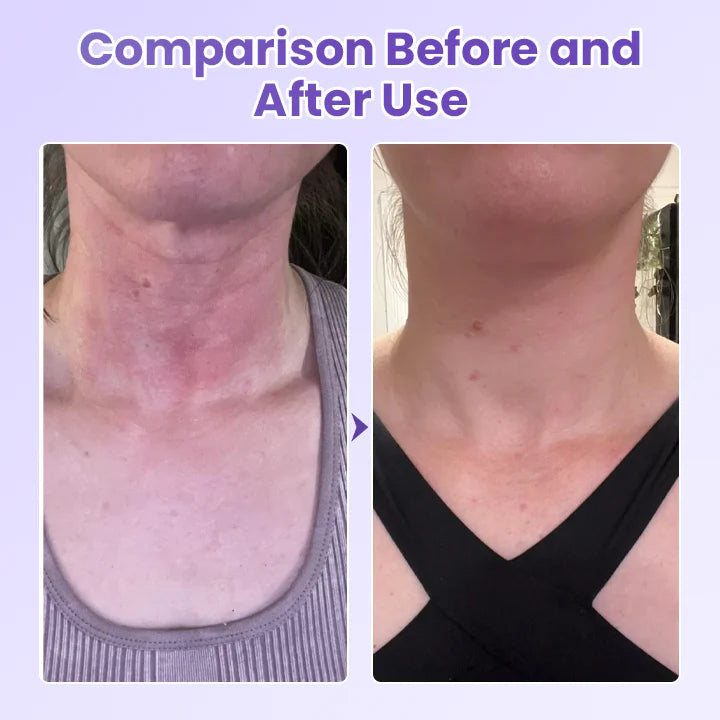 Peptide Anti Wrinkle Patch