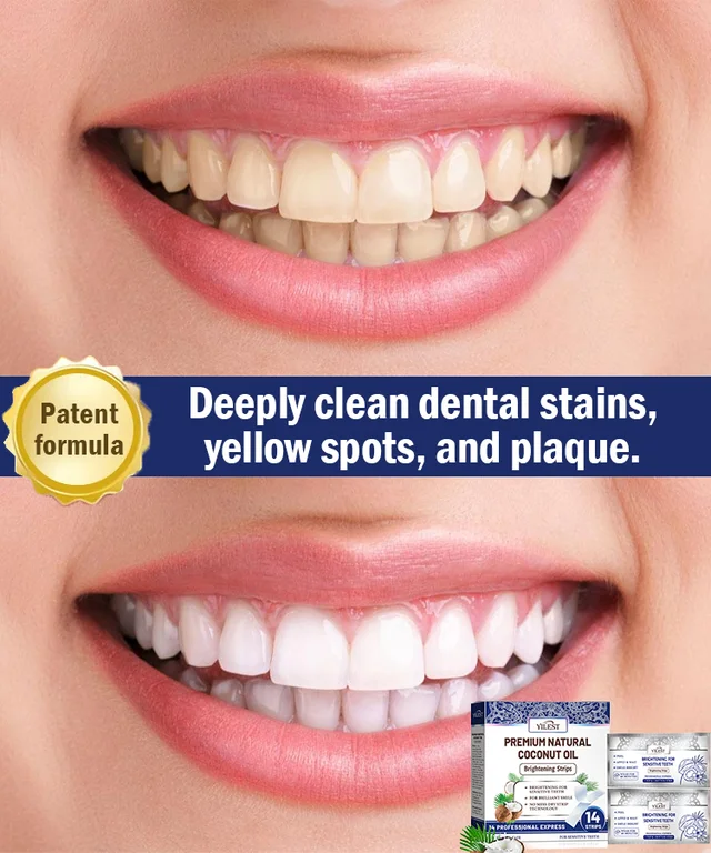 Coconut Mint Whitening Strips
