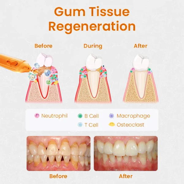 Gum Repair Treatment Ampoules