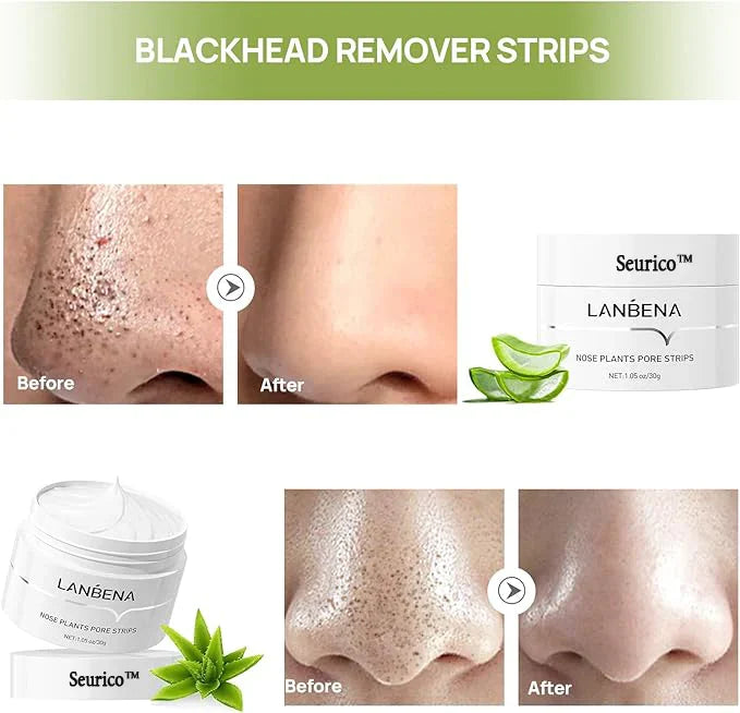 Blackhead Remover Mask: The Ultimate Solution for Clear Skin