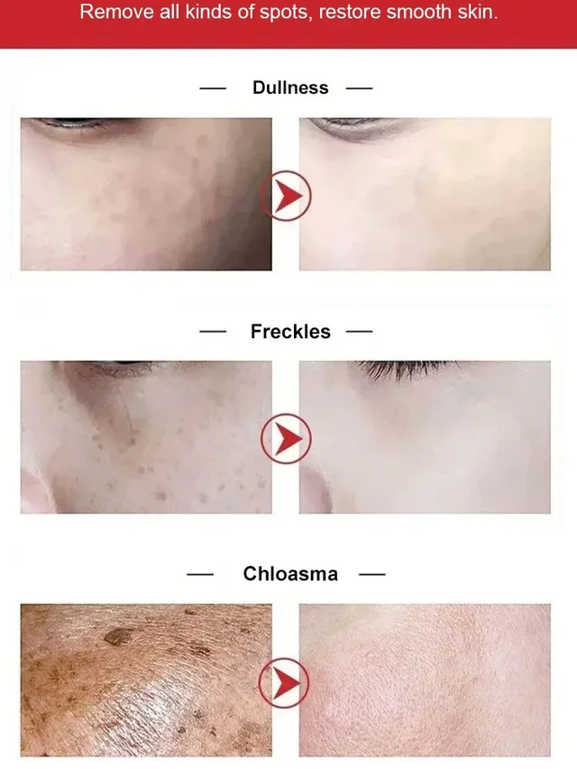 Whitening Spotlight Facial Serum Serum Hydration Extra Brightening Niacinamide Beautiful Skin Serum
