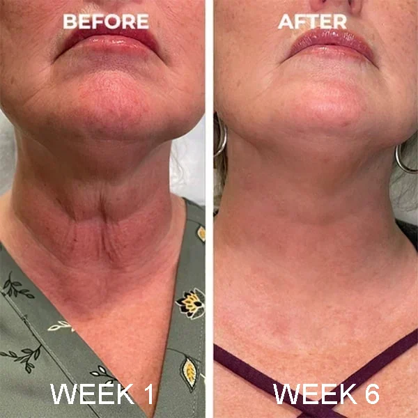 🔥Last Day Promotion 49% OFF 🔥Botox Anti-Aging Serum