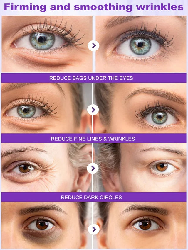Wrinkle-Retinol Firming Eye Cream🔥BUY 1 GET 1 FREE🔥