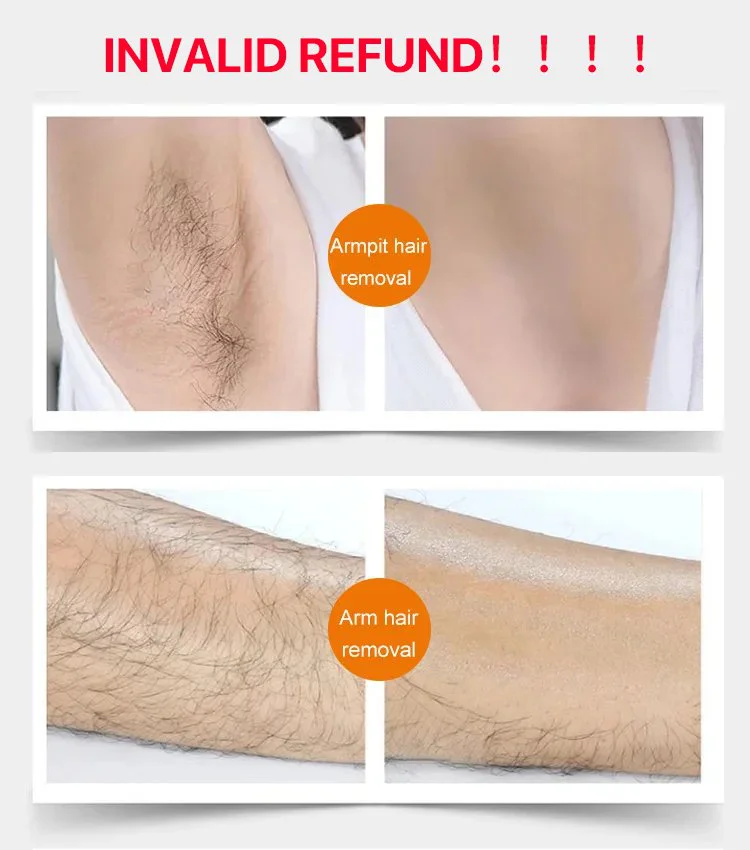 HANKEY hair removal cream