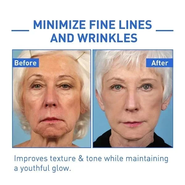 SUMAX Retinol Anti Aging Face Cream