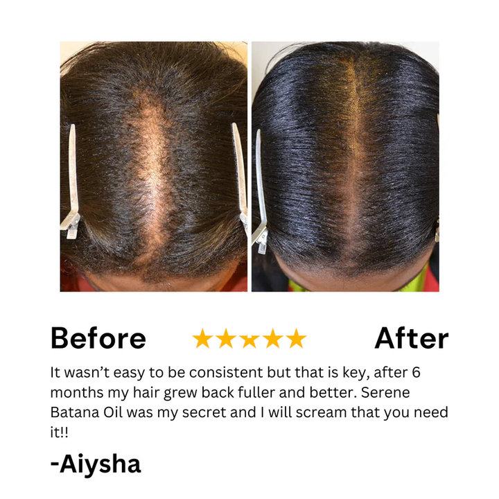 Batana natural Hair Growth Oil