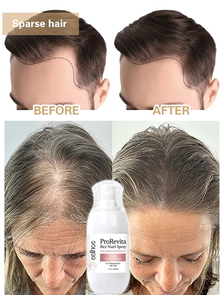 Rice Water Hair Growth Spray