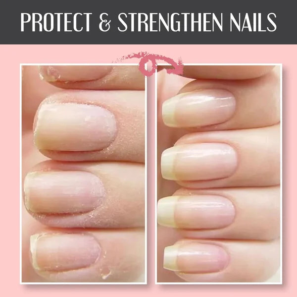 🔥Hot Sale-48% OFF-2024 NAIL REPAIR PROTECTION GEL