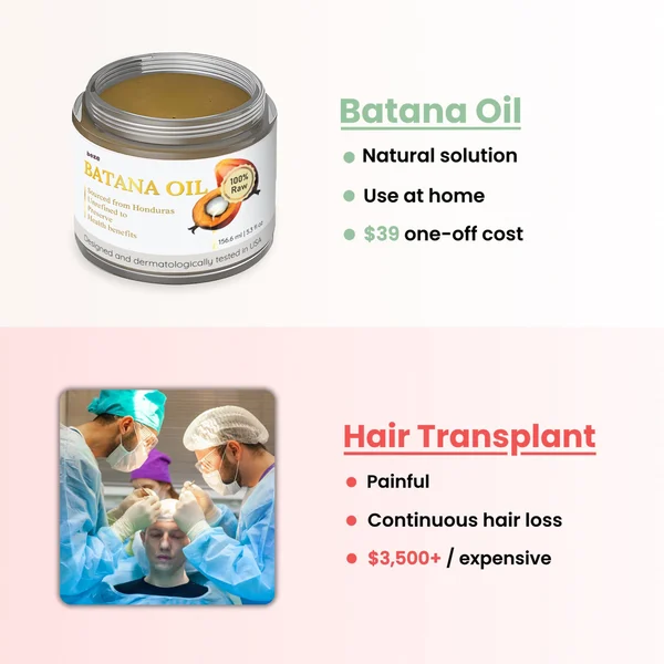 Batana Bliss Natural Hair Growth Oil