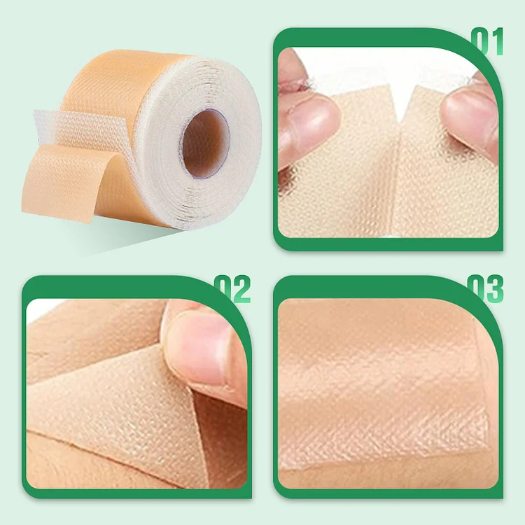 Reusable Silicone Scar Sheets for Surgical Scars