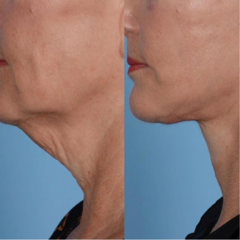 Lifting Firming Neck Cream