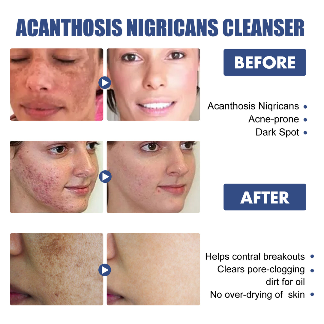 Deep Cleansing Lotion
