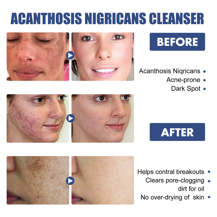 Deep Cleansing Lotion