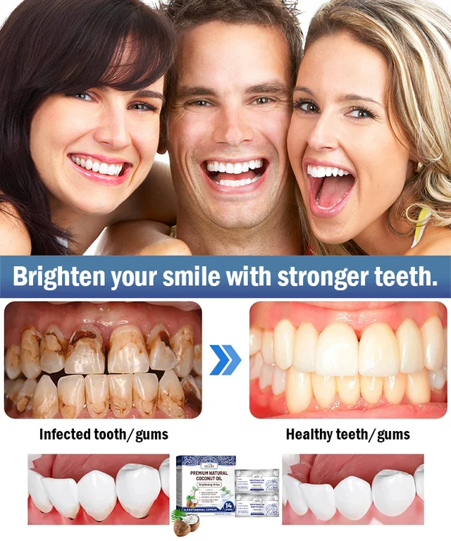 Coconut Mint Whitening Strips