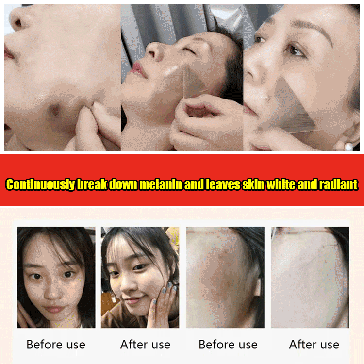 Whitening and rejuvenating spots removal mask