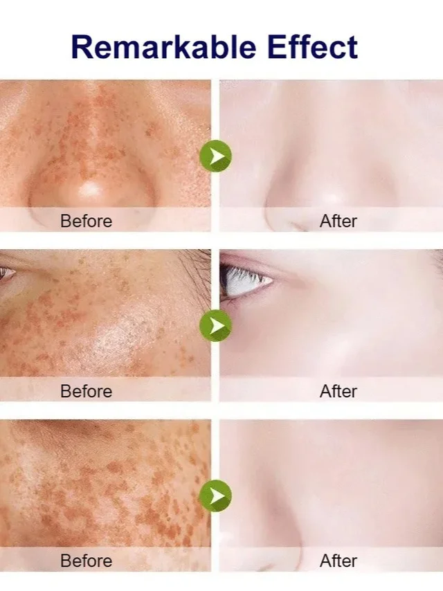 Whitening Spotlight Facial Serum Serum Hydration Extra Brightening Niacinamide Beautiful Skin Serum