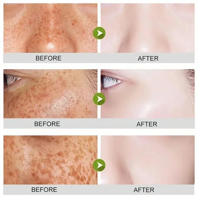 Centella Asiatica Bubble Mask